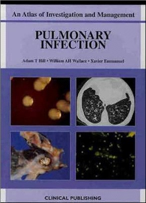 Pulmonary Infection：An Atlas of Investigation and Management