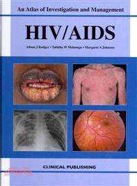 HIV/AIDS