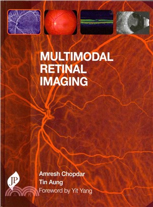 Multimodal Retinal Imaging