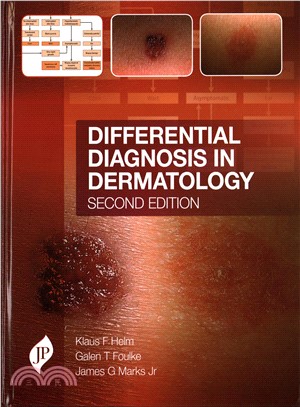 Differential Diagnosis in Dermatology