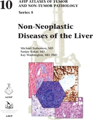 Non-Neoplastic Diseases of the Liver