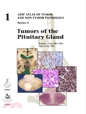Tumors of the pituitary gland / by Sylvia L. Asa and Arie Perry.