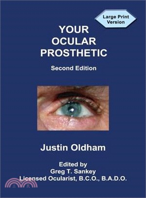 Your Ocular Prosthetic