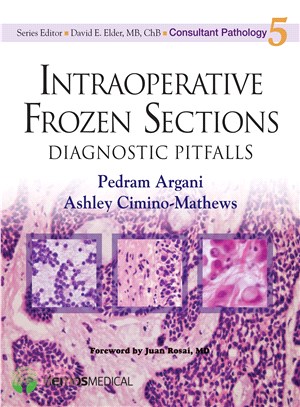 Intraoperative Frozen Sections ― Diagnostic Pitfalls