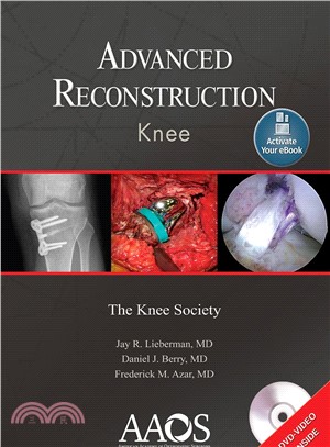 Advanced Reconstruction Knee