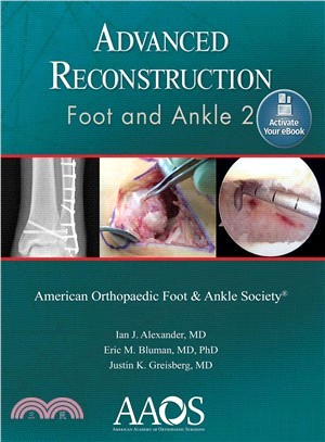 Advanced Reconstruction ― Foot and Ankle