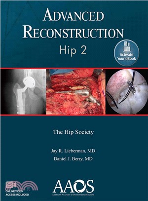 Advanced Reconstruction Hip