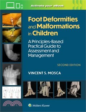 Foot Deformities and Malformations in Children: A Principles-Based, Practical Guide to Assessment and Management: Print + eBook with Multimedia