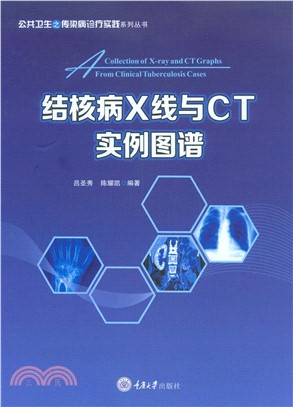 结核病X线与CT实例图谱(電子書)