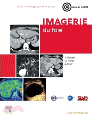 Imagerie Du Foie