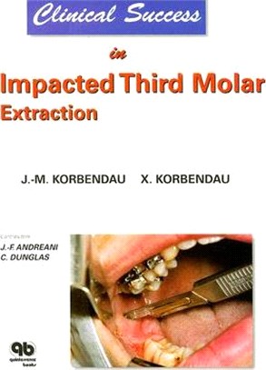 Clinical Success In Impacted Third Molar Extraction