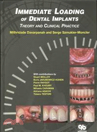 Immediate Loading of Dental Implants