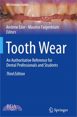 Tooth Wear: An Authoritative Reference for Dental Professionals and Students
