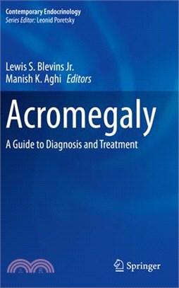 Acromegaly: A Guide to Diagnosis and Treatment