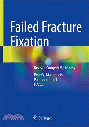 Failed Fracture Fixation: Revision Surgery Made Easy