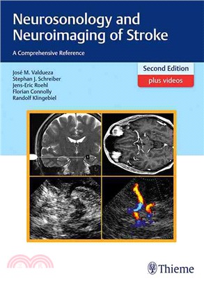 Neurosonology and Neuroimaging of Stroke ─ A Comprehensive Reference