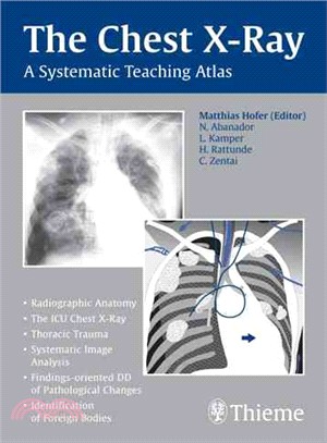 The Chest X-Ray ─ A Systematic Teaching Atlas