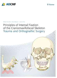 Principles of Internal Fixation of the Craniomaxillofacial Skeleton—Trauma and Orthognathic Surgery