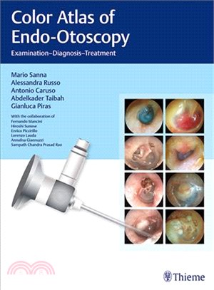 Color Atlas of Endo-Otoscopy ─ Examination-Diagnosis-Treatment