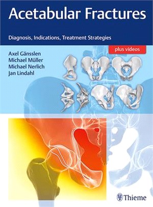 Acetabular Fractures ― Diagnosis, Indications, Treatment Strategies