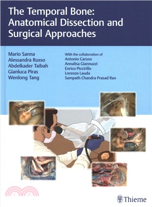 The Temporal Bone ― Anatomical Dissection and Surgical Approaches