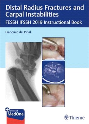 Distal Radius Fractures and Carpal Instabilities ― Fessh Ifssh 2019 Instructional Book