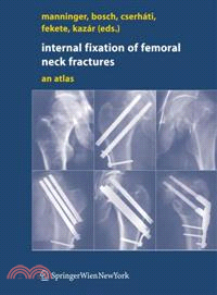 Internal Fixation of Femoral Neck Fractures ─ An Atlas