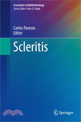 Scleritis