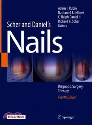 Scher and Daniel's Nails + Ereference ― Diagnosis, Surgery, Therapy