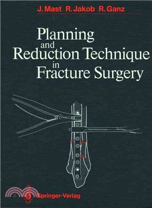 Planning and Reduction Technique in Fracture Surgery