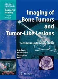 Imaging Bone Tumors and Tumor-Like Lesions—Techniques and Applications