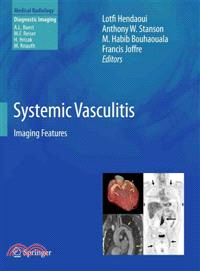 Systemic Vasculitis ─ Imaging Features