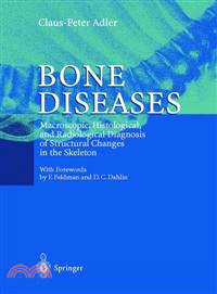 Bone Diseases