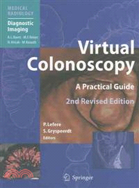 Virtual Colonoscopy