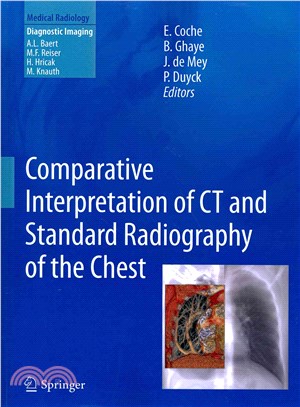 Comparative Interpretation of Ct and Standard Radiography of the Chest