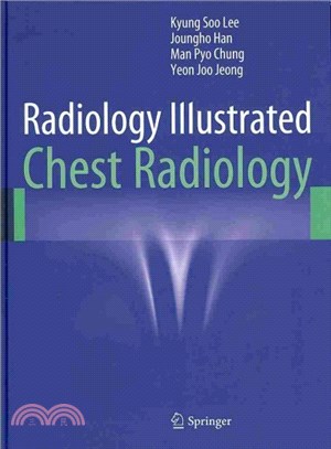 Radiology Illustrated ― Chest Radiology