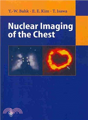 Nuclear Imaging of the Chest