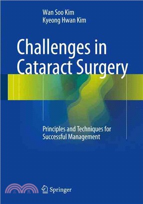 Challenges in cataract surge...