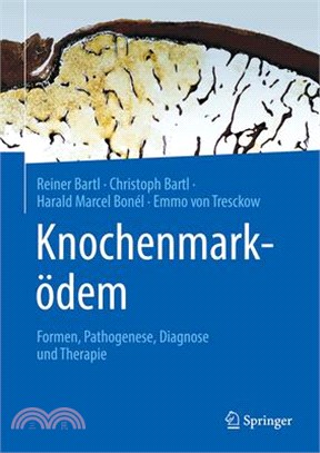 Knochenmarködem: Formen, Pathogenese, Diagnose Und Therapie