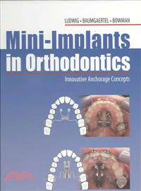 Mini-implants in Orthodontics—Innovative Anchorage Concepts