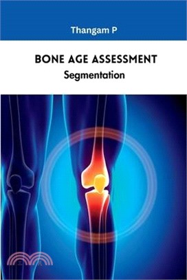 Bone Age Assessment Segmentation