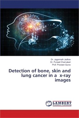 Detection of bone, skin and lung cancer in a x-ray images