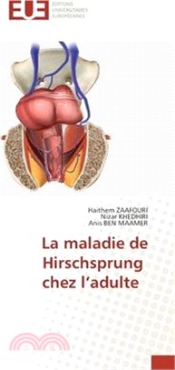 La maladie de Hirschsprung chez l'adulte