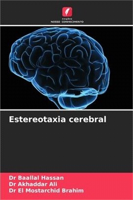 Estereotaxia cerebral