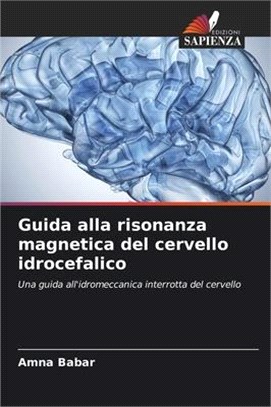 Guida alla risonanza magnetica del cervello idrocefalico