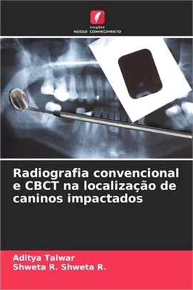 Radiografia convencional e CBCT na localização de caninos impactados