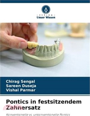 Pontics in festsitzendem Zahnersatz