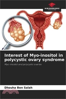 Interest of Myo-inositol in polycystic ovary syndrome