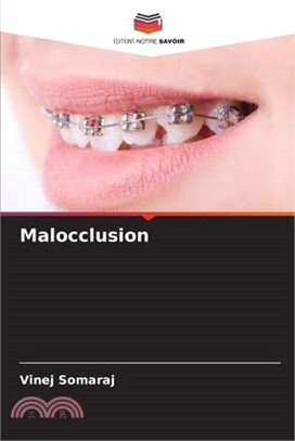 Malocclusion