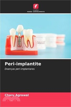 Peri-implantite